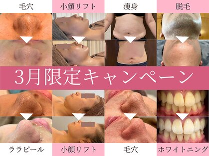 トワ 大宮(TOWA)の写真