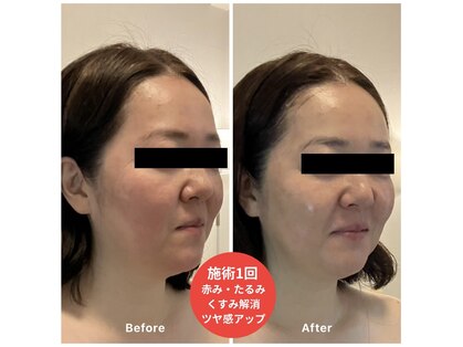 フワリ(fuwari)の写真