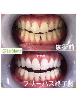 ルブラン 奈良店(Le Blanc)/たったの3週間で