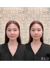 代官山コンディショニング/施術例【マッサージ/肩こり】