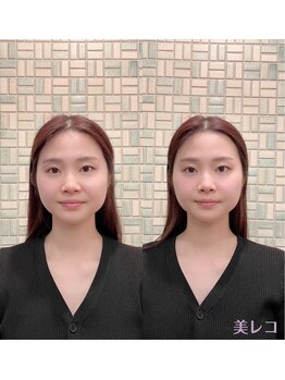 代官山コンディショニング/施術例【マッサージ/肩こり】