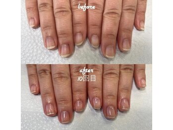 ネイルサロン ユーズ(USE.)/最強のネイルケア/自爪育成