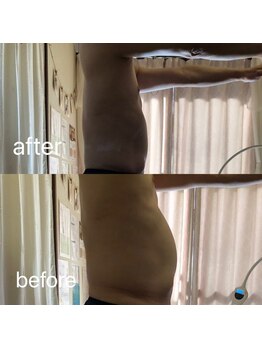 ナナラ(nanala)/ポッコリお腹撃退コース!