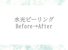 ブリリアン デイスパ 阪急西宮ガーデンズ店(BRILLIAN DAYSPA)/before→after