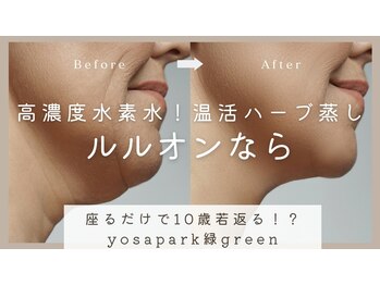 ヨサパーク グリーン(YOSA PARK 緑 green)の写真/根本改善に特化したプロの施術で本気痩せ！辛いダイエットはもうやめませんか？健康的に痩せたい方必見◎