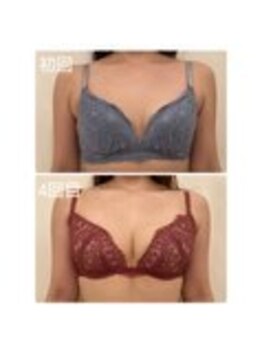 美人バスト 表参道店/【バストアップ/育乳 症例】
