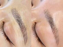 アーピス アイ(APIS eye)
