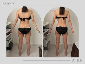 リー(Riy)/《Before and After》20代