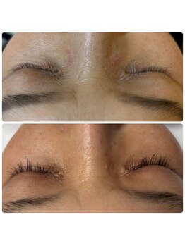 アリガトウ サロン シンパシー(A.Salon Sympathy)/まつ毛に変化!まつ毛サロンケア