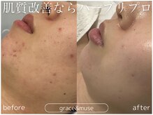 グレイス アンド ミューズ(grace&muse)