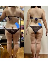 ニコワ(Nicowa)/Nicowaの痩身★BeforeAfter