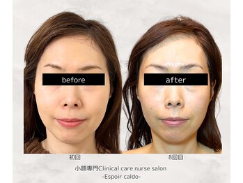 エスポワールカルド(Espoir caldo)/