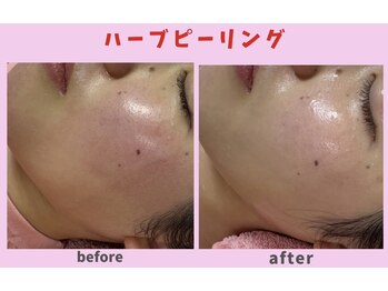 サロン ほほえむ(Fofo-m)/