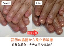 ネイルサロン プロムナード(nailsalon promnade)/即日で見た目の改善が叶います！