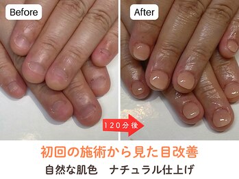 ネイルサロン プロムナード(nailsalon promnade)/即日で見た目の改善が叶います！