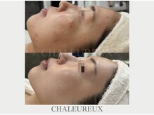 サロン ド ボーテ シャルル(Chaleureux)/