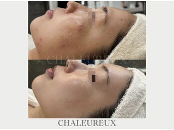 サロン ド ボーテ シャルル(Chaleureux)/