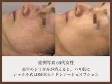 シャルル ストア 京都三条通(Chaleureux Store)/