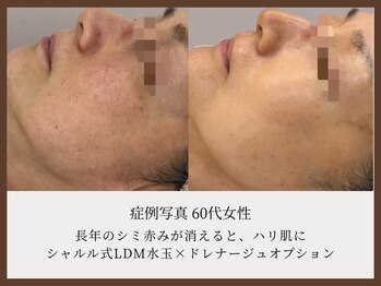 シャルル ストア 京都三条通(Chaleureux Store)/