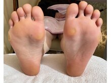 ビサンテ サロン/フットケア・角質ケアはビサンテ
