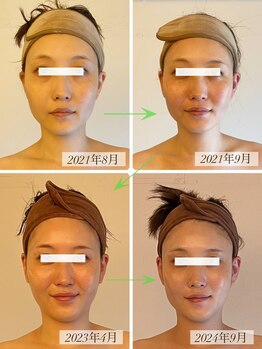 パル コルギサロン(Pal. Korugi salon)/コルギビフォーアフター