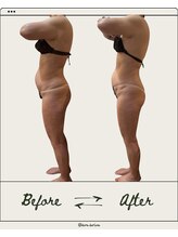 ドゥ ドルチェ(Due dolce)/ぽっこりお腹もさよなら　1回