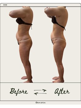 ドゥ ドルチェ(Due dolce)/ぽっこりお腹もさよなら　1回