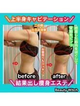 ビューティ ウィッチ(Beauty Witch)/