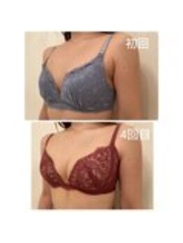 美人バスト 表参道店/【バストアップ/育乳 症例】