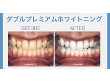 マイントゥー(mine too)/プレミアムジェルも！