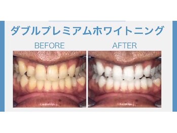 マイントゥー(mine too)/プレミアムジェルも!