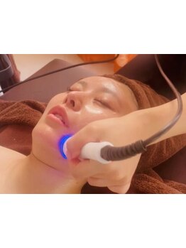 小顔になりたい