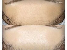 オンダム 表参道(ONDAM)/みんな憧れるなめらか陶器肌♪