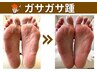 【人気NO.2】角質から魚の目/60分ケアし放題♪フットシャンプー付♪
