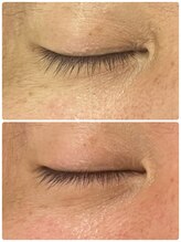 マニス(manis)/ヒト幹細胞培養液