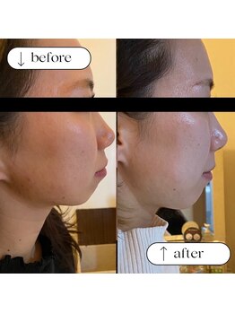 トータルビューティーサロンリア(Li'a)/ビフォー＆アフター