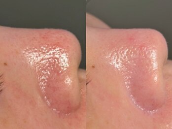 ルーナジェーナ(Luna llena)/池袋 エステ ルーナジェーナ