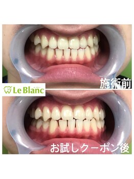 ルブラン 奈良店(Le Blanc)/お得なペア割り！！