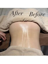 ルネアススパ 南青山(Lune’as Spa)/《WINBACK》腰、くびれ