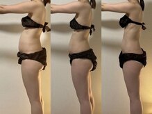 ヨサパーク 新百合ヶ丘店(YOSA PARK)の雰囲気（しつこいセル脂肪を燃焼し、すっきり美脚を実現★）