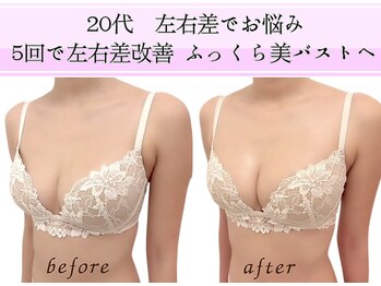 ビーハピネス 京都西院(B-Happiness)/20代左右差月2回+バストクリーム