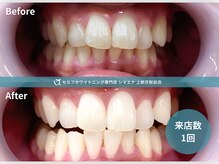 シマエナ 上新庄駅前店の雰囲気（初回980円で白い歯へ！当日予約OKのホワイトニング◎）