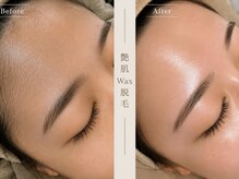 コア ビューティースタジオ(KOA Beauty Studio)の雰囲気（毛穴レスなつるんと艶肌を目指す方に）