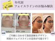 ジ エステティック イーズ ららぽーと福岡店の雰囲気(全世代に人気!気になる顔の脂肪へ【レモンボトル】体験8800円)