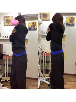 ヒデ整体院(Hide整体院)/猫背矯正骨盤矯正B/A肩こり腰痛