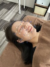 たてもと鍼灸接骨院/美容鍼