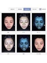 ウニ(uni)/こだわりの肌診断器