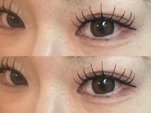 ナナリスボン 福岡(NANA LISBON)/アンドヘルシー160本