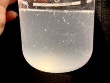 バタフライ 津田沼店(Butterfly)/毛穴洗浄ハイドロスプラッシュ