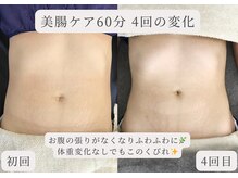 エイル(Eir.)/【腸もみ】before/after